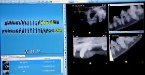 digital-dental-xrays-DSC_9977-edited