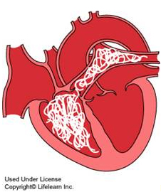 cartoon heart with heartworm