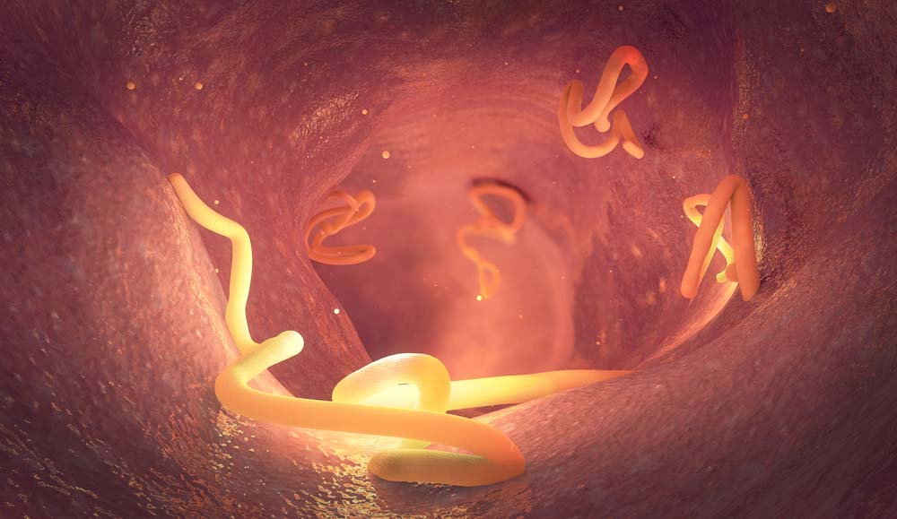 Illustration of tapeworms in an intestine